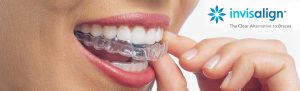 Clínica dental proveedora de ortodoncia invisalign