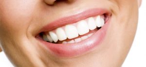 Dentista Zaragoza - Como hacer un blanqueamiento dental