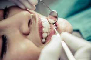 ¿Qué es una corona dental Tipos y cuándo se necesita
